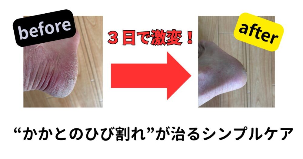 かかとシンプルケア